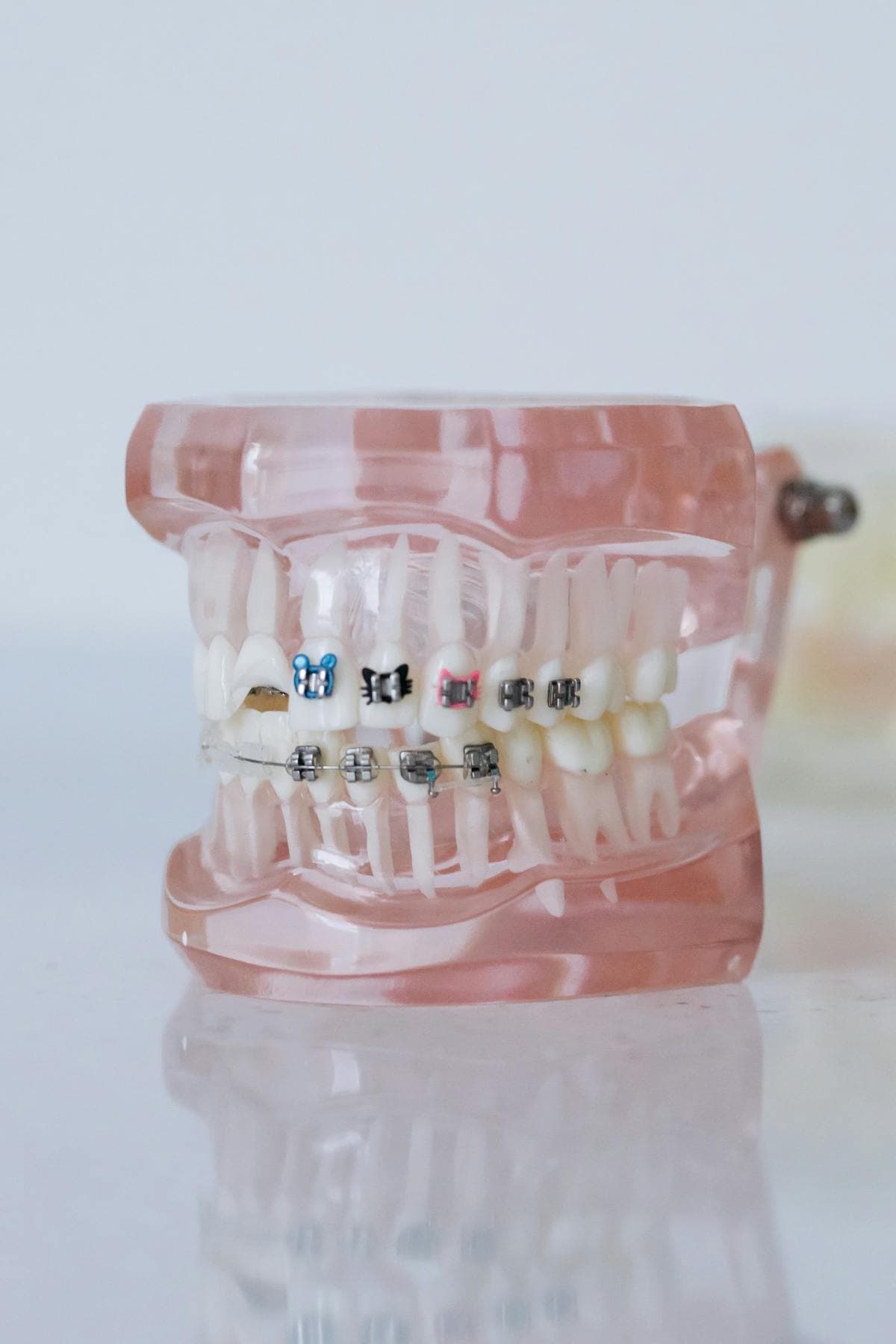 Premium cosmetic denture with individually characterized teeth