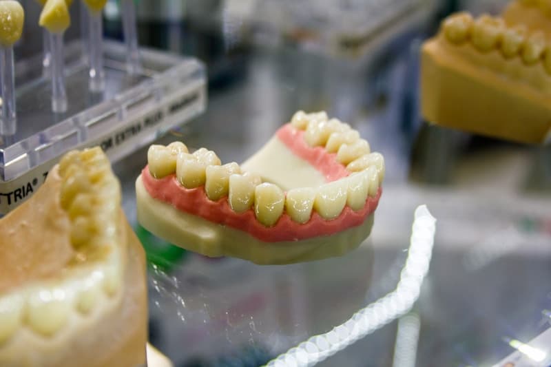 All-Ceramic Restorations